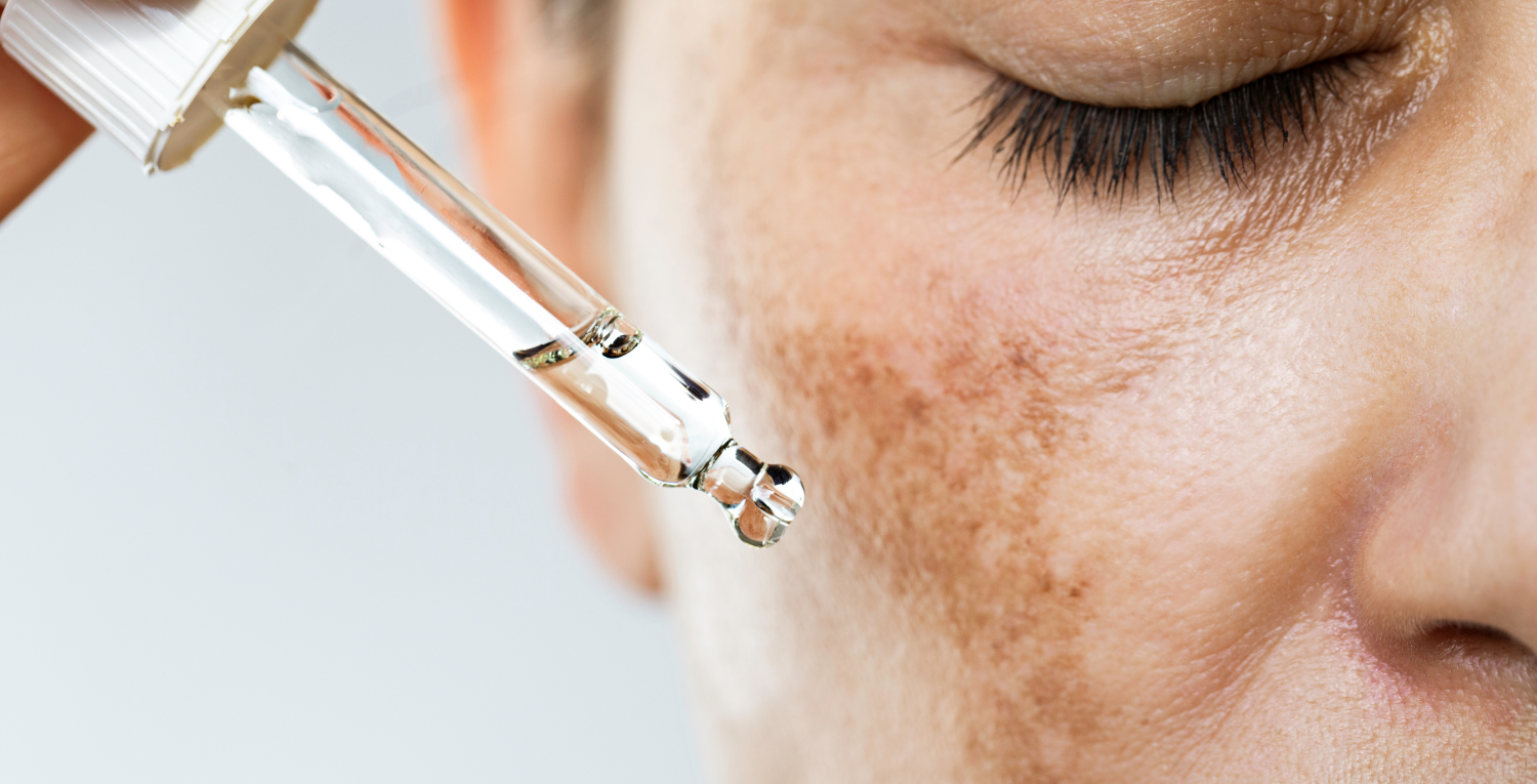 The Best Hyperpigmentation Treatment: Why Glutathione Beats Vitamin C Prfkt The Best Hyperpigmentation Treatment: Why Glutathione Beats Vitamin C Prfkt